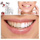 Natural Teeth Whitening Powder